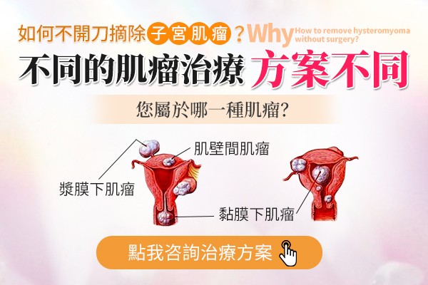 深圳子宮肌瘤海扶刀手術